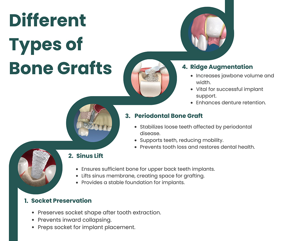 types of bone grafts