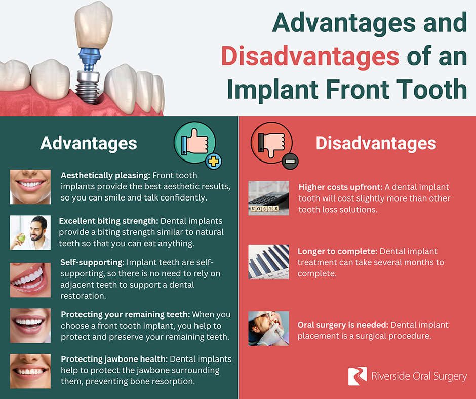 Advantages and disadvantages implant front tooth