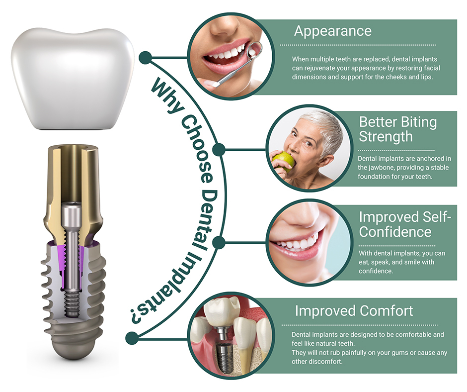 https://www.riversideoralsurgery.com/wp-content/uploads/2023/11/why-choose-dental-implants-info.jpg