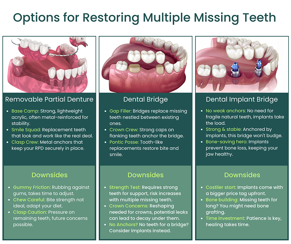 Options for Restoring Multiple Missing Teeth